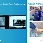 ניתוב וצילום ניתוח בלייב