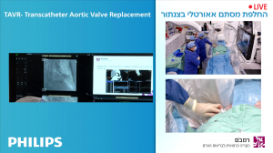ניתוב וצילום ניתוח בלייב