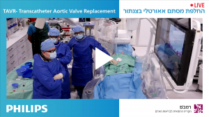 שידור חי של ניתוח